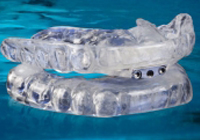 Oral-Appliance-Picture-1[1]