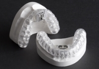 Oral-Appliance-Picture-2[2]
